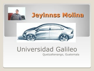 Jeyinnss Molina




Universidad Galileo
        Quetzaltenango, Guatemala
 