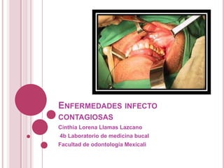 ENFERMEDADES INFECTO
CONTAGIOSAS
Cinthia Lorena Llamas Lazcano
4b Laboratorio de medicina bucal
Facultad de odontología Mexicali
 