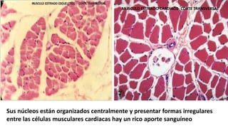 MUSCULO ESTRIADO CARDIACO- CORTE TRANSVERSAL
Sus núcleos están organizados centralmente y presentar formas irregulares
entre las células musculares cardiacas hay un rico aporte sanguíneo
 