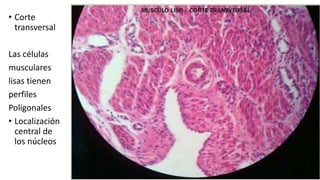 • Corte
transversal
Las células
musculares
lisas tienen
perfiles
Poligonales
• Localización
central de
los núcleos
 