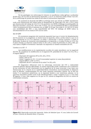 En las patologías con sobrecarga de volumen se manifiestan ondas q finas y profundas
(0,025 seg y de 0,2 mV) en derivaciones izquierdas, y en V1 se observan ondas r finas >0,3 mV.
En la sobrecarga de presión las ondas R son altas en derivaciones izquierdas
En ocasiones la duración del QRS se prolonga tanto que simula un BCRI. Inicialmente
suele verse disminución del voltaje hasta la desaparición de ondas q en DI, aVL y V5-6, junto
por disminución del voltaje de r en V1-2. En pacientes con BCRI el hallazgo ecocardiográfico de
HVI está asociado a: (S en V2) + (R en V6) >4,5mV, con una sensibilidad del 86% y especificidad
100%; la presencia de DAI se relacionó con un QRS >0,16 seg. Una onda S >2,5 mV en V3 tiene
una sensibilidad del 56% y una especificidad del 90%. El hallazgo de BCRI indica la
simultaneidad de CVI en hasta el 93% de los casos.
Eje del QRS
El crecimiento progresivo del ventrículo izquierdo hace que el vector de despolarización
del VI aumente en su magnitud, su desvío hacia la izquierda, atrás y arriba induce a que en el
plano horizontal en V1-2 se observen: a) ondas r minúsculas o incluso ausentes y ondas S
profundas, b) plano de transición está desplazado a la izquierda, y c) ondas R altas en V5-6. En
el plano frontal, se observan ondas R altas en DI y aVL y ondas S profundas en aVF y DIII, por
esta razón el ÂQRS es horizontal o desviado a la izquierda en estados avanzados de CVI.
Cambios en el ST - T
Las modificaciones en la repolarización suceden de modo simultáneo con la magnitud
del CVI. Se consideran la modificación en el segmento ST, polaridad de la onda T en V2 y V6, y
el ángulo QRS/T.
- Depresión del segmento ST en DI, aVL y V5-6.
- Onda T alta en V2
- Onda T negativa en V6 > 0,1mV (convexidad superior en rama descendente)
- Ángulo QRS/T >100° en V5-6.
- Depresión del ST e inversión de la onda T en DI y aVL.
El diagnóstico diferencial entre la sobrecarga ventricular del CVI y enfermedad
coronaria plantea algunas dificultades; la misma hipertrofia puede condicionar que el diámetro
de las coronarias no esté relacionado con la magnitud de la masa muscular y que haya una
disminución de la relación de la capilaridad/fibras miocárdicas incrementándose la distancia
para la difusión, condicionándose de este modo isquemia miocárdica relativa. En la HVI las
ondas T se mantienen asimétricas, en la isquemia tienden a ser simétricas; además, en la
isquemia miocárdica pueden verse el ST infradesnivelado u onda T negativa en V1-2. Una onda
T negativa >3 mm, más negativa en V6 que en V5, orienta al diagnóstico de HVI en contra de
enfermedad coronaria.
Figura 5.3. Hipertrofia ventricular izquierda. Indice de Sokolow-Lyon: 41 mm; Indice de Cornell
29 mm. Criterios de Romhilt-Estes 12 puntos.
 