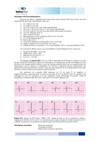 Hallazgos electrocardiográficos:
El grupo de Myers y Sokolow-Lyon postularon unos criterios ECG que tienen una alta
especificidad, pero baja sensibilidad, estos son:
1. V1: onda R >0,7 mV.
2. V1: onda S <0,2 mV.
3. V5 ó V6: onda S >0,7 mV. (baja especificidad)
4. (R en V1) + (S en V5 ó V6) >1,1 mV. (baja especificidad)
5. V5 ó V6: onda R <0,5 mV (en ausencia de enfermedad coronaria).
6. V5 ó V6: Relación R/S <1.
7. aVR: onda R >0,5 mV.
8. (Relación R/S en V5) / (Relación R/S en V1) <0,4 mV.
9. V1 ó V3R: Relación R/S >1.
10. Patrón qR en V1.
11. Inicio de la deflexión intrinsecoide en V1: >0,04 seg.
12. Onda T negativa en V1 (si onda R >0,5 mV).
13. ÂQRS desviado a la derecha: >110°. (sensibilidad <20%, y una especificidad >95%)
Los criterios de Milnor tienen una sensibilidad y especificidad del 75%, estos son:
1. Duración del QRS: < 0,12 seg.
2. ÂQRS entre +110 y 180°.
3. Relación R o R’/S en V1: > 1.
4. R en V1: > 0,5 mV.
El hallazgo del patrón qR en V1 y/o V3R es específico de CVD severo, excepto en casos
de pre-excitación ventricular, infarto de miocardio y la combinación de IM con bloqueo de ram
derecha; esta imagen podría deberse a que las fuerzas septales derechas son mayores que las
izquierdas y que el septum se despolarice de derecha a izquierda (están relacionadas con
hipertensión arterial pulmonar severa), o que sea una expresión de la despolarización auricular
derecha, o bien se deba a una rotación extrema del VD.
En presencia de complejo QRS positivos en V1 la onda T es negativa, o
negativa/positiva, y generalmente se asocia a inversión de la T en DII-III y aVF; en conjunto, los
hallazgos en V1-2 se asemejan a lo que redescribe como sobrecarga de presión: ondas R
monofásica o bifásicas (qR, RS o Rs) e inversión de la onda T (Figura 5.6).
Figura 5.6. Patrón de CVD típico. ÂQRS +100°. Ondas R altas en V1-2, asociadas a ondas T
negativas en DII-III y aVF y en V1-4, y persistencia de ondas s hasta V6. Onda P positiva en V1-
2 (DAD). La paciente era portadora de hipertensión arterial pulmonar primaria severa.
Patologías asociadas: Estenosis pulmonar.
Tetralogía de Fallot.
Hipertensión pulmonar primaria.
 