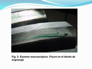 Fig. 2: Examen macroscópico. Fisura en el diente de
engranaje
 