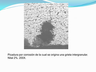 Picadura por corrosión de la cual se origina una grieta intergranular.
Nital 2%. 200X.
 