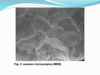Fig. 3: examen microscópico (MEB)
 