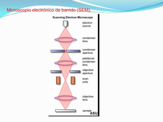 Microscopio electrónico de barrido (SEM).
 