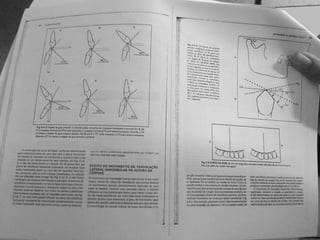 Capitulo 6 - Determinantes da morfologia oclusal