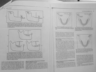 Capitulo 6 - Determinantes da morfologia oclusal