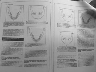 Capitulo 6 - Determinantes da morfologia oclusal