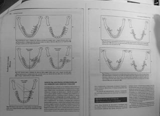 Capitulo 6 - Determinantes da morfologia oclusal