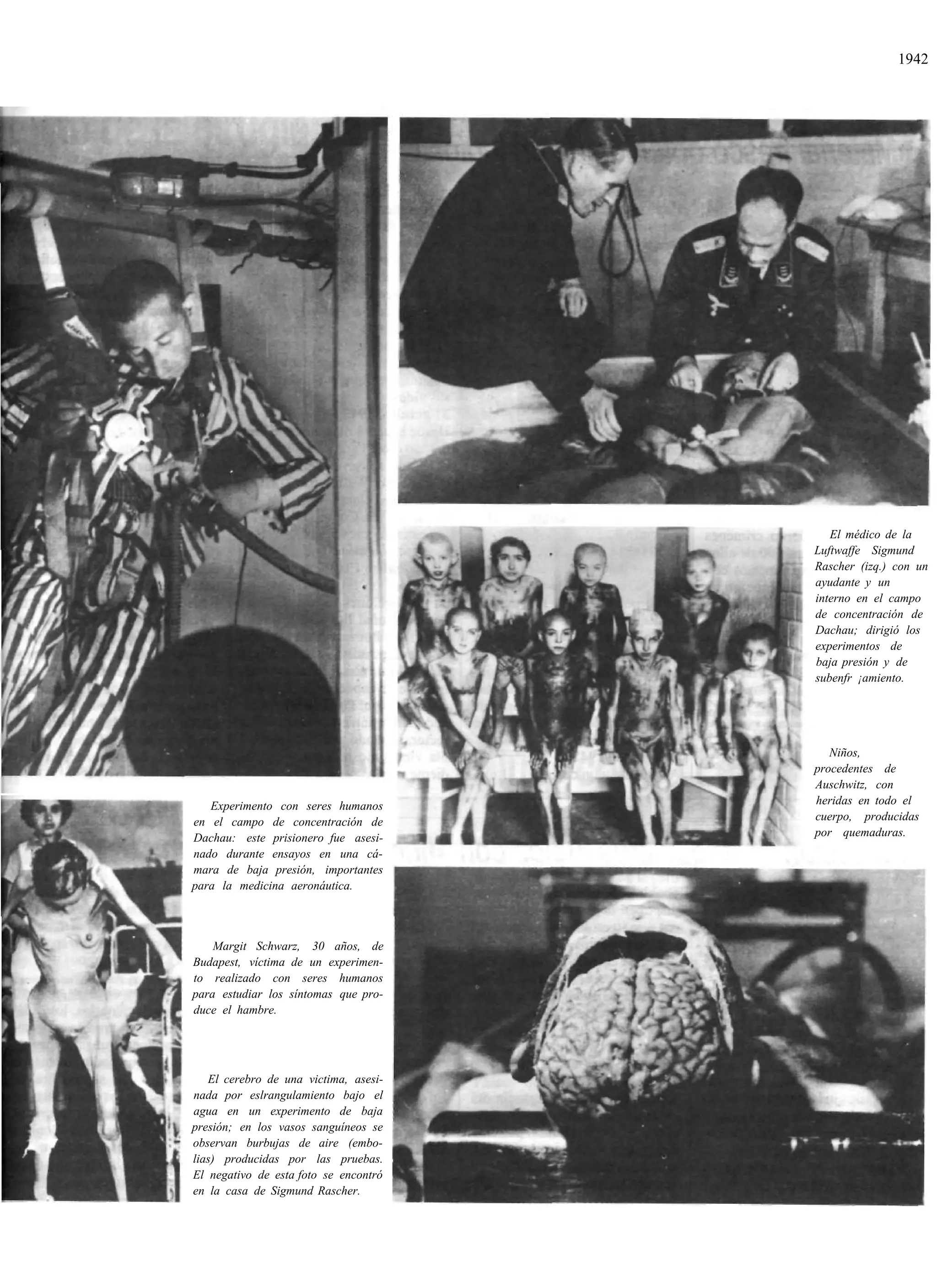 1942




                                          El médico de la
                                       Luftwaffe Sigmund
                                       Rascher (izq.) con un
                                       ayudante y un
                                       interno en el campo
                                       de concentración de
                                       Dachau; dirigió los
                                       experimentos de
                                       baja presión y de
                                       subenfr ¡amiento.




                                          Niños,
                                       procedentes de
                                       Auschwitz, con
   Experimento con seres humanos       heridas en todo el
en el campo de concentración de        cuerpo, producidas
Dachau: este prisionero fue asesi-     por quemaduras.
nado durante ensayos en una cá-
mara de baja presión, importantes
para la medicina aeronáutica.



    Margit Schwarz, 30 años, de
Budapest, víctima de un experimen-
to realizado con seres humanos
para estudiar los síntomas que pro-
duce el hambre.




   El cerebro de una victima, asesi-
nada por eslrangulamiento bajo el
agua en un experimento de baja
presión; en los vasos sanguíneos se
observan burbujas de aire (embo-
lias) producidas por las pruebas.
El negativo de esta foto se encontró
en la casa de Sigmund Rascher.
 