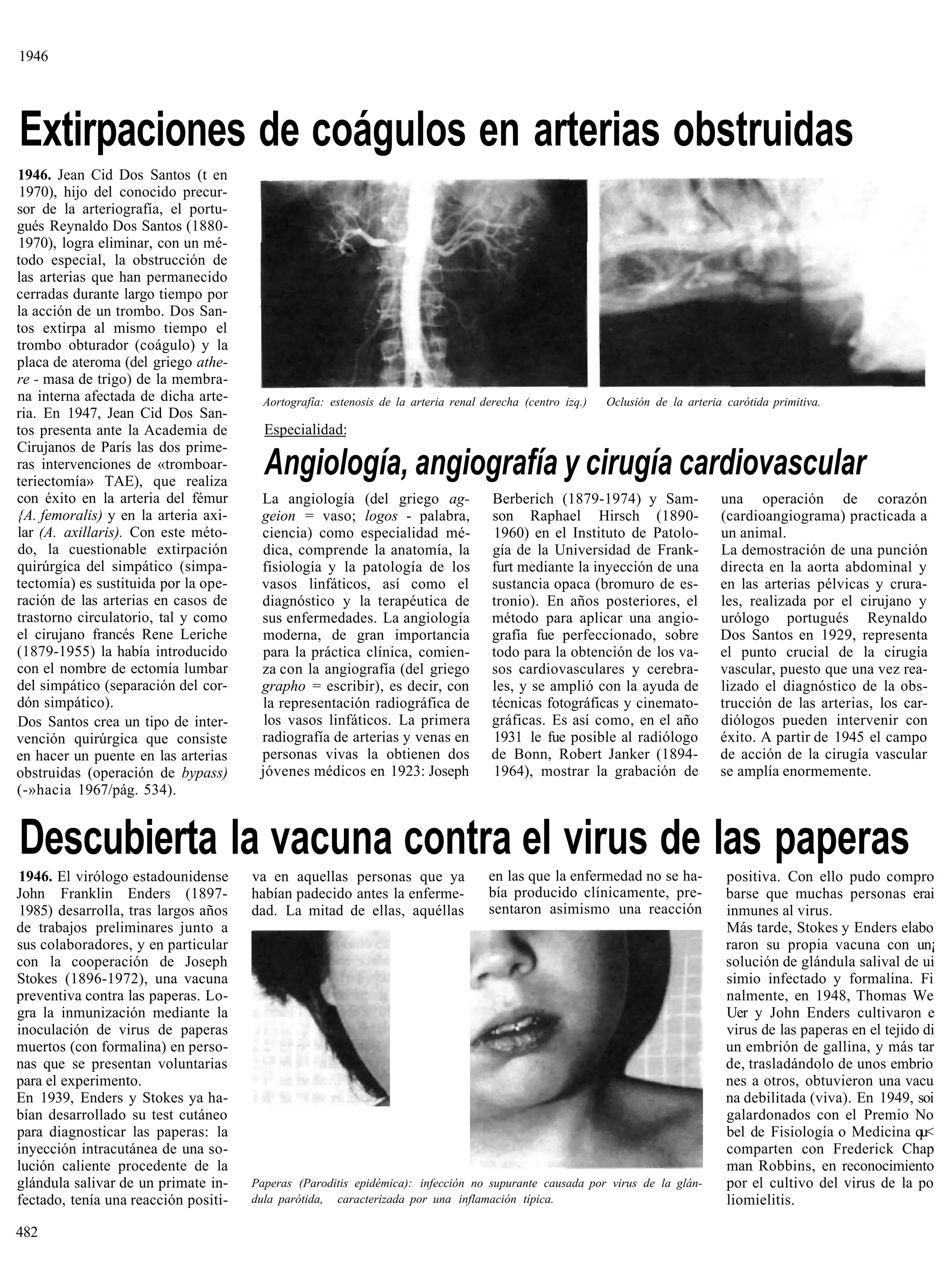 1946




Extirpaciones de coágulos en arterias obstruidas
1946. Jean Cid Dos Santos (t en
 1970), hijo del conocido precur-
sor de la arteriografía, el portu-
gués Reynaldo Dos Santos (1880-
1970), logra eliminar, con un mé-
todo especial, la obstrucción de
las arterias que han permanecido
cerradas durante largo tiempo por
la acción de un trombo. Dos San-
tos extirpa al mismo tiempo el
trombo obturador (coágulo) y la
placa de ateroma (del griego athe-
re - masa de trigo) de la membra-
na interna afectada de dicha arte-      Aortografía: estenosis de la arteria renal derecha (centro izq.)   Oclusión de la arteria carótida primitiva.
ria. En 1947, Jean Cid Dos San-
tos presenta ante la Academia de        Especialidad:
Cirujanos de París las dos prime-
ras intervenciones de «tromboar-
teriectomía» TAE), que realiza
                                        Angiología, angiografía y cirugía cardiovascular
con éxito en la arteria del fémur      La angiología (del griego ag-                 Berberich (1879-1974) y Sam-                una operación de corazón
{A. femoralis) y en la arteria axi-    geion = vaso; logos - palabra,                son Raphael Hirsch (1890-                   (cardioangiograma) practicada a
lar (A. axillaris). Con este méto-     ciencia) como especialidad mé-                1960) en el Instituto de Patolo-            un animal.
do, la cuestionable extirpación        dica, comprende la anatomía, la               gía de la Universidad de Frank-             La demostración de una punción
quirúrgica del simpático (simpa-       fisiología y la patología de los              furt mediante la inyección de una           directa en la aorta abdominal y
tectomía) es sustituida por la ope-    vasos linfáticos, así como el                 sustancia opaca (bromuro de es-             en las arterias pélvicas y crura-
ración de las arterias en casos de     diagnóstico y la terapéutica de               tronio). En años posteriores, el            les, realizada por el cirujano y
trastorno circulatorio, tal y como     sus enfermedades. La angiología               método para aplicar una angio-              urólogo portugués Reynaldo
el cirujano francés Rene Leriche       moderna, de gran importancia                  grafía fue perfeccionado, sobre             Dos Santos en 1929, representa
(1879-1955) la había introducido       para la práctica clínica, comien-             todo para la obtención de los va-           el punto crucial de la cirugía
con el nombre de ectomía lumbar        za con la angiografía (del griego             sos cardiovasculares y cerebra-             vascular, puesto que una vez rea-
del simpático (separación del cor-     grapho = escribir), es decir, con             les, y se amplió con la ayuda de            lizado el diagnóstico de la obs-
dón simpático).                        la representación radiográfica de             técnicas fotográficas y cinemato-           trucción de las arterias, los car-
Dos Santos crea un tipo de inter-       los vasos linfáticos. La primera             gráficas. Es así como, en el año            diólogos pueden intervenir con
vención quirúrgica que consiste        radiografía de arterias y venas en            1931 le fue posible al radiólogo            éxito. A partir de 1945 el campo
en hacer un puente en las arterias     personas vivas la obtienen dos                de Bonn, Robert Janker (1894-               de acción de la cirugía vascular
obstruidas (operación de bypass)       jóvenes médicos en 1923: Joseph               1964), mostrar la grabación de              se amplía enormemente.
(-»hacia 1967/pág. 534).


Descubierta la vacuna contra el virus de las paperas
1946. El virólogo estadounidense      va en aquellas personas que ya                en las que la enfermedad no se ha-            positiva. Con ello pudo compro
John Franklin Enders (1897-           habían padecido antes la enferme-             bía producido clínicamente, pre-              barse que muchas personas erai
1985) desarrolla, tras largos años    dad. La mitad de ellas, aquéllas              sentaron asimismo una reacción                inmunes al virus.
de trabajos preliminares junto a                                                                                                  Más tarde, Stokes y Enders elabo
sus colaboradores, y en particular                                                                                                raron su propia vacuna con un¡
con la cooperación de Joseph                                                                                                      solución de glándula salival de ui
Stokes (1896-1972), una vacuna                                                                                                    simio infectado y formalina. Fi
preventiva contra las paperas. Lo-                                                                                                nalmente, en 1948, Thomas We
gra la inmunización mediante la                                                                                                   Uer y John Enders cultivaron e
inoculación de virus de paperas                                                                                                   virus de las paperas en el tejido di
muertos (con formalina) en perso-                                                                                                 un embrión de gallina, y más tar
nas que se presentan voluntarias                                                                                                  de, trasladándolo de unos embrio
para el experimento.                                                                                                              nes a otros, obtuvieron una vacu
En 1939, Enders y Stokes ya ha-                                                                                                   na debilitada (viva). En 1949, soi
bían desarrollado su test cutáneo                                                                                                 galardonados con el Premio No
para diagnosticar las paperas: la                                                                                                 bel de Fisiología o Medicina qu<
inyección intracutánea de una so-                                                                                                 comparten con Frederick Chap
lución caliente procedente de la                                                                                                  man Robbins, en reconocimiento
glándula salivar de un primate in-    Paperas (Paroditis epidémica): infección no supurante causada por virus de la glán-         por el cultivo del virus de la po
fectado, tenía una reacción positi-   dula parótida, caracterizada por una inflamación típica.                                    liomielitis.

482
 