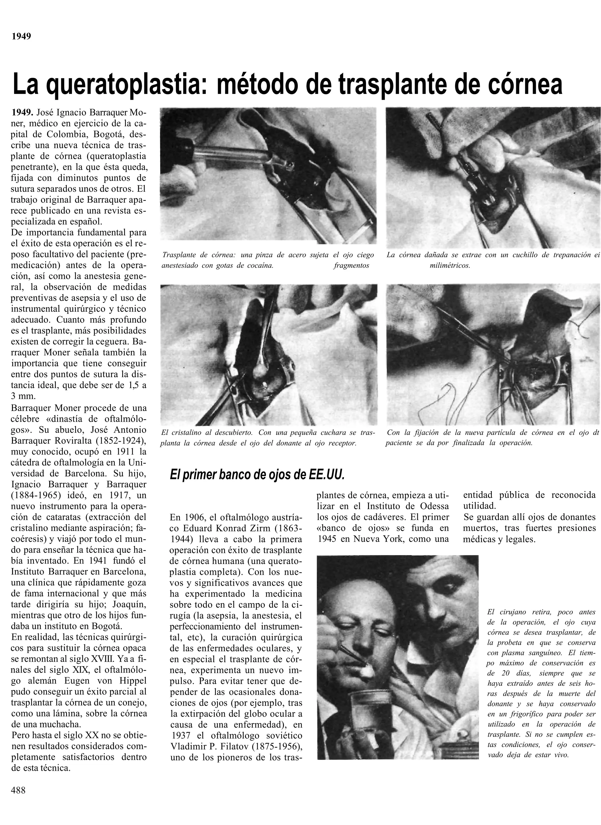 1949




La queratoplastia: método de trasplante de córnea
1949. José Ignacio Barraquer Mo-
ner, médico en ejercicio de la ca-
pital de Colombia, Bogotá, des-
cribe una nueva técnica de tras-
plante de córnea (queratoplastia
penetrante), en la que ésta queda,
fijada con diminutos puntos de
sutura separados unos de otros. El
trabajo original de Barraquer apa-
rece publicado en una revista es-
pecializada en español.
De importancia fundamental para
el éxito de esta operación es el re-
poso facultativo del paciente (pre-    Trasplante de córnea: una pinza de acero sujeta el ojo ciego     La córnea dañada se extrae con un cuchillo de trepanación ei
medicación) antes de la opera-         anestesiado con gotas de cocaína.               fragmentos                  milimétricos.
ción, así como la anestesia gene-
ral, la observación de medidas
preventivas de asepsia y el uso de
instrumental quirúrgico y técnico
adecuado. Cuanto más profundo
es el trasplante, más posibilidades
existen de corregir la ceguera. Ba-
rraquer Moner señala también la
importancia que tiene conseguir
entre dos puntos de sutura la dis-
tancia ideal, que debe ser de 1,5 a
3 mm.
Barraquer Moner procede de una
célebre «dinastía de oftalmólo-
gos». Su abuelo, José Antonio          El cristalino al descubierto. Con una pequeña cuchara se tras-   Con la fijación de la nueva partícula de córnea en el ojo dt
Barraquer Roviralta (1852-1924),       planta la córnea desde el ojo del donante al ojo receptor.       paciente se da por finalizada la operación.
muy conocido, ocupó en 1911 la
cátedra de oftalmología en la Uni-
versidad de Barcelona. Su hijo,          El primer banco de ojos de EE.UU.
Ignacio Barraquer y Barraquer
(1884-1965) ideó, en 1917, un                                                       plantes de córnea, empieza a uti-        entidad pública de reconocida
nuevo instrumento para la opera-                                                    lizar en el Instituto de Odessa          utilidad.
ción de cataratas (extracción del        En 1906, el oftalmólogo austría-           los ojos de cadáveres. El primer         Se guardan allí ojos de donantes
cristalino mediante aspiración; fa-      co Eduard Konrad Zirm (1863-               «banco de ojos» se funda en              muertos, tras fuertes presiones
coéresis) y viajó por todo el mun-       1944) lleva a cabo la primera              1945 en Nueva York, como una             médicas y legales.
do para enseñar la técnica que ha-       operación con éxito de trasplante
bía inventado. En 1941 fundó el          de córnea humana (una querato-
Instituto Barraquer en Barcelona,        plastia completa). Con los nue-
una clínica que rápidamente goza         vos y significativos avances que
de fama internacional y que más          ha experimentado la medicina
tarde dirigiría su hijo; Joaquín,        sobre todo en el campo de la ci-
mientras que otro de los hijos fun-                                                                                                 El cirujano retira, poco antes
                                         rugía (la asepsia, la anestesia, el
                                                                                                                                    de la operación, el ojo cuya
daba un instituto en Bogotá.             perfeccionamiento del instrumen-
                                                                                                                                    córnea se desea trasplantar, de
En realidad, las técnicas quirúrgi-      tal, etc), la curación quirúrgica                                                          la probeta en que se conserva
cos para sustituir la córnea opaca       de las enfermedades oculares, y                                                            con plasma sanguíneo. El tiem-
se remontan al siglo XVIII. Ya a fi-     en especial el trasplante de cór-                                                          po máximo de conservación es
nales del siglo XIX, el oftalmólo-       nea, experimenta un nuevo im-                                                              de 20 días, siempre que se
go alemán Eugen von Hippel               pulso. Para evitar tener que de-                                                           haya extraído antes de seis ho-
pudo conseguir un éxito parcial al       pender de las ocasionales dona-                                                            ras después de la muerte del
trasplantar la córnea de un conejo,      ciones de ojos (por ejemplo, tras                                                          donante y se haya conservado
como una lámina, sobre la córnea         la extirpación del globo ocular a                                                          en un frigorífico para poder ser
de una muchacha.                         causa de una enfermedad), en                                                               utilizado en la operación de
Pero hasta el siglo XX no se obtie-       1937 el oftalmólogo soviético                                                             trasplante. Si no se cumplen es-
nen resultados considerados com-         Vladimir P. Filatov (1875-1956),                                                           tas condiciones, el ojo conser-
pletamente satisfactorios dentro         uno de los pioneros de los tras-                                                           vado deja de estar vivo.
de esta técnica.

488
 