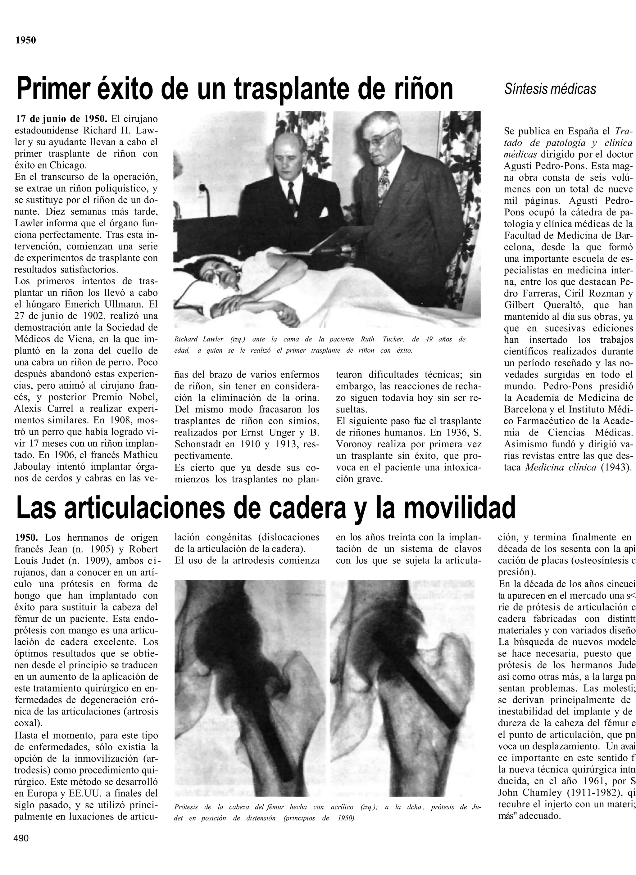 1950




Primer éxito de un trasplante de riñon                                                                                           Síntesis médicas
 17 de junio de 1950. El cirujano
estadounidense Richard H. Law-                                                                                                   Se publica en España el Tra-
ler y su ayudante llevan a cabo el                                                                                               tado de patología y clínica
primer trasplante de riñon con                                                                                                   médicas dirigido por el doctor
éxito en Chicago.                                                                                                                Agustí Pedro-Pons. Esta mag-
En el transcurso de la operación,                                                                                                na obra consta de seis volú-
se extrae un riñon poliquístico, y                                                                                               menes con un total de nueve
se sustituye por el riñon de un do-                                                                                              mil páginas. Agustí Pedro-
nante. Diez semanas más tarde,                                                                                                   Pons ocupó la cátedra de pa-
Lawler informa que el órgano fun-                                                                                                tología y clínica médicas de la
ciona perfectamente. Tras esta in-                                                                                               Facultad de Medicina de Bar-
tervención, comienzan una serie                                                                                                  celona, desde la que formó
de experimentos de trasplante con                                                                                                una importante escuela de es-
resultados satisfactorios.                                                                                                       pecialistas en medicina inter-
Los primeros intentos de tras-                                                                                                   na, entre los que destacan Pe-
plantar un riñon los llevó a cabo                                                                                                dro Farreras, Ciril Rozman y
el húngaro Emerich Ullmann. El                                                                                                   Gilbert Queraltó, que han
27 de junio de 1902, realizó una                                                                                                 mantenido al día sus obras, ya
demostración ante la Sociedad de                                                                                                 que en sucesivas ediciones
Médicos de Viena, en la que im-        Richard Lawler (izq.) ante la cama de la paciente Ruth       Tucker,   de 49 años de      han insertado los trabajos
plantó en la zona del cuello de        edad,   a quien se le realizó el primer trasplante de riñon con éxito.                    científicos realizados durante
una cabra un riñon de perro. Poco                                                                                                un período reseñado y las no-
después abandonó estas experien-       ñas del brazo de varios enfermos                 tearon dificultades técnicas; sin        vedades surgidas en todo el
cias, pero animó al cirujano fran-     de riñon, sin tener en considera-                embargo, las reacciones de recha-        mundo. Pedro-Pons presidió
cés, y posterior Premio Nobel,         ción la eliminación de la orina.                 zo siguen todavía hoy sin ser re-        la Academia de Medicina de
Alexis Carrel a realizar experi-       Del mismo modo fracasaron los                    sueltas.                                 Barcelona y el Instituto Médi-
mentos similares. En 1908, mos-        trasplantes de riñon con simios,                 El siguiente paso fue el trasplante      co Farmacéutico de la Acade-
tró un perro que había logrado vi-     realizados por Ernst Unger y B.                  de riñones humanos. En 1936, S.          mia de Ciencias Médicas.
vir 17 meses con un riñon implan-      Schonstadt en 1910 y 1913, res-                  Voronoy realiza por primera vez          Asimismo fundó y dirigió va-
tado. En 1906, el francés Mathieu      pectivamente.                                    un trasplante sin éxito, que pro-        rias revistas entre las que des-
Jaboulay intentó implantar órga-       Es cierto que ya desde sus co-                   voca en el paciente una intoxica-        taca Medicina clínica (1943).
nos de cerdos y cabras en las ve-      mienzos los trasplantes no plan-                 ción grave.


Las articulaciones de cadera y la movilidad
1950. Los hermanos de origen           lación congénitas (dislocaciones                 en los años treinta con la implan-      ción, y termina finalmente en
francés Jean (n. 1905) y Robert        de la articulación de la cadera).                tación de un sistema de clavos          década de los sesenta con la api
Louis Judet (n. 1909), ambos c i -     El uso de la artrodesis comienza                 con los que se sujeta la articula-      cación de placas (osteosíntesis c
rujanos, dan a conocer en un artí-                                                                                              presión).
culo una prótesis en forma de                                                                                                   En la década de los años cincuei
hongo que han implantado con                                                                                                    ta aparecen en el mercado una s<
éxito para sustituir la cabeza del                                                                                              rie de prótesis de articulación c
fémur de un paciente. Esta endo-                                                                                                cadera fabricadas con distintt
prótesis con mango es una articu-                                                                                               materiales y con variados diseño
lación de cadera excelente. Los                                                                                                 La búsqueda de nuevos modele
óptimos resultados que se obtie-                                                                                                se hace necesaria, puesto que
nen desde el principio se traducen                                                                                              prótesis de los hermanos Jude
en un aumento de la aplicación de                                                                                               así como otras más, a la larga pn
este tratamiento quirúrgico en en-                                                                                              sentan problemas. Las molesti;
fermedades de degeneración cró-                                                                                                 se derivan principalmente de
nica de las articulaciones (artrosis                                                                                            inestabilidad del implante y de
coxal).                                                                                                                         dureza de la cabeza del fémur e
Hasta el momento, para este tipo                                                                                                el punto de articulación, que pn
de enfermedades, sólo existía la                                                                                                voca un desplazamiento. Un avaí
opción de la inmovilización (ar-                                                                                                ce importante en este sentido f
trodesis) como procedimiento qui-                                                                                               la nueva técnica quirúrgica intn
rúrgico. Este método se desarrolló                                                                                              ducida, en el año 1961, por S
en Europa y EE.UU. a finales del                                                                                                John Chamley (1911-1982), qi
siglo pasado, y se utilizó princi-     Prótesis de la cabeza del fémur hecha con acrílico (izq.); a la dcha., prótesis de Ju-   recubre el injerto con un materi;
palmente en luxaciones de articu-      det en posición de distensión   (principios de   1950).                                  más" adecuado.

490
 