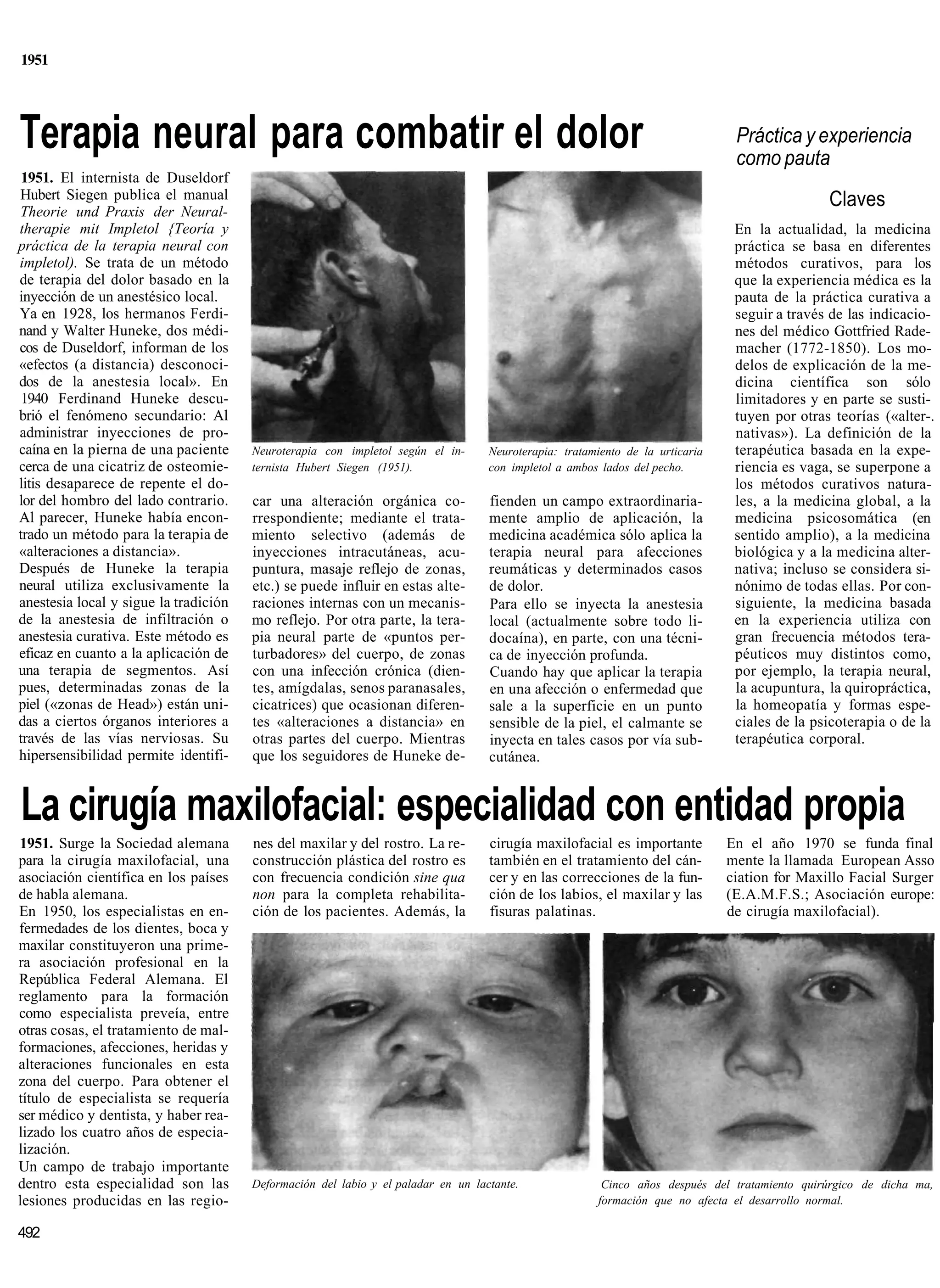 1951




Terapia neural para combatir el dolor                                                                                           Práctica y experiencia
                                                                                                                                como pauta
 1951. El internista de Duseldorf
Hubert Siegen publica el manual                                                                                                                Claves
Theorie und Praxis der Neural-
therapie mit Impletol {Teoría y                                                                                                 En la actualidad, la medicina
práctica de la terapia neural con                                                                                               práctica se basa en diferentes
impletol). Se trata de un método                                                                                                métodos curativos, para los
de terapia del dolor basado en la                                                                                               que la experiencia médica es la
inyección de un anestésico local.                                                                                               pauta de la práctica curativa a
Ya en 1928, los hermanos Ferdi-                                                                                                 seguir a través de las indicacio-
nand y Walter Huneke, dos médi-                                                                                                 nes del médico Gottfried Rade-
cos de Duseldorf, informan de los                                                                                               macher (1772-1850). Los mo-
«efectos (a distancia) desconoci-                                                                                               delos de explicación de la me-
dos de la anestesia local». En                                                                                                  dicina científica son sólo
 1940 Ferdinand Huneke descu-                                                                                                   limitadores y en parte se susti-
brió el fenómeno secundario: Al                                                                                                 tuyen por otras teorías («alter-.
administrar inyecciones de pro-                                                                                                 nativas»). La definición de la
caína en la pierna de una paciente     Neuroterapia con impletol según el in-      Neuroterapia: tratamiento de la urticaria    terapéutica basada en la expe-
cerca de una cicatriz de osteomie-     ternista Hubert Siegen (1951).              con impletol a ambos lados del pecho.        riencia es vaga, se superpone a
litis desaparece de repente el do-                                                                                              los métodos curativos natura-
lor del hombro del lado contrario.     car una alteración orgánica co-             fienden un campo extraordinaria-             les, a la medicina global, a la
Al parecer, Huneke había encon-        rrespondiente; mediante el trata-           mente amplio de aplicación, la               medicina psicosomática (en
trado un método para la terapia de     miento selectivo (además de                 medicina académica sólo aplica la            sentido amplio), a la medicina
«alteraciones a distancia».            inyecciones intracutáneas, acu-             terapia neural para afecciones               biológica y a la medicina alter-
Después de Huneke la terapia           puntura, masaje reflejo de zonas,           reumáticas y determinados casos              nativa; incluso se considera si-
neural utiliza exclusivamente la       etc.) se puede influir en estas alte-       de dolor.                                    nónimo de todas ellas. Por con-
anestesia local y sigue la tradición   raciones internas con un mecanis-           Para ello se inyecta la anestesia            siguiente, la medicina basada
de la anestesia de infiltración o      mo reflejo. Por otra parte, la tera-        local (actualmente sobre todo li-            en la experiencia utiliza con
anestesia curativa. Este método es     pia neural parte de «puntos per-            docaína), en parte, con una técni-           gran frecuencia métodos tera-
eficaz en cuanto a la aplicación de    turbadores» del cuerpo, de zonas            ca de inyección profunda.                    péuticos muy distintos como,
una terapia de segmentos. Así          con una infección crónica (dien-            Cuando hay que aplicar la terapia            por ejemplo, la terapia neural,
pues, determinadas zonas de la         tes, amígdalas, senos paranasales,          en una afección o enfermedad que             la acupuntura, la quiropráctica,
piel («zonas de Head») están uni-      cicatrices) que ocasionan diferen-          sale a la superficie en un punto             la homeopatía y formas espe-
das a ciertos órganos interiores a     tes «alteraciones a distancia» en           sensible de la piel, el calmante se          ciales de la psicoterapia o de la
través de las vías nerviosas. Su       otras partes del cuerpo. Mientras           inyecta en tales casos por vía sub-          terapéutica corporal.
hipersensibilidad permite identifi-    que los seguidores de Huneke de-            cutánea.


La cirugía maxilofacial: especialidad con entidad propia
1951. Surge la Sociedad alemana        nes del maxilar y del rostro. La re-        cirugía maxilofacial es importante          En el año 1970 se funda final
para la cirugía maxilofacial, una      construcción plástica del rostro es         también en el tratamiento del cán-          mente la llamada European Asso
asociación científica en los países    con frecuencia condición sine qua           cer y en las correcciones de la fun-        ciation for Maxillo Facial Surger
de habla alemana.                      non para la completa rehabilita-            ción de los labios, el maxilar y las        (E.A.M.F.S.; Asociación europe:
En 1950, los especialistas en en-      ción de los pacientes. Además, la           fisuras palatinas.                          de cirugía maxilofacial).
fermedades de los dientes, boca y
maxilar constituyeron una prime-
ra asociación profesional en la
República Federal Alemana. El
reglamento para la formación
como especialista preveía, entre
otras cosas, el tratamiento de mal-
formaciones, afecciones, heridas y
alteraciones funcionales en esta
zona del cuerpo. Para obtener el
título de especialista se requería
ser médico y dentista, y haber rea-
lizado los cuatro años de especia-
lización.
Un campo de trabajo importante
dentro esta especialidad son las       Deformación del labio y el paladar en un lactante.               Cinco años después del tratamiento quirúrgico de dicha ma,
lesiones producidas en las regio-                                                                      formación que no afecta el desarrollo normal.

492
 