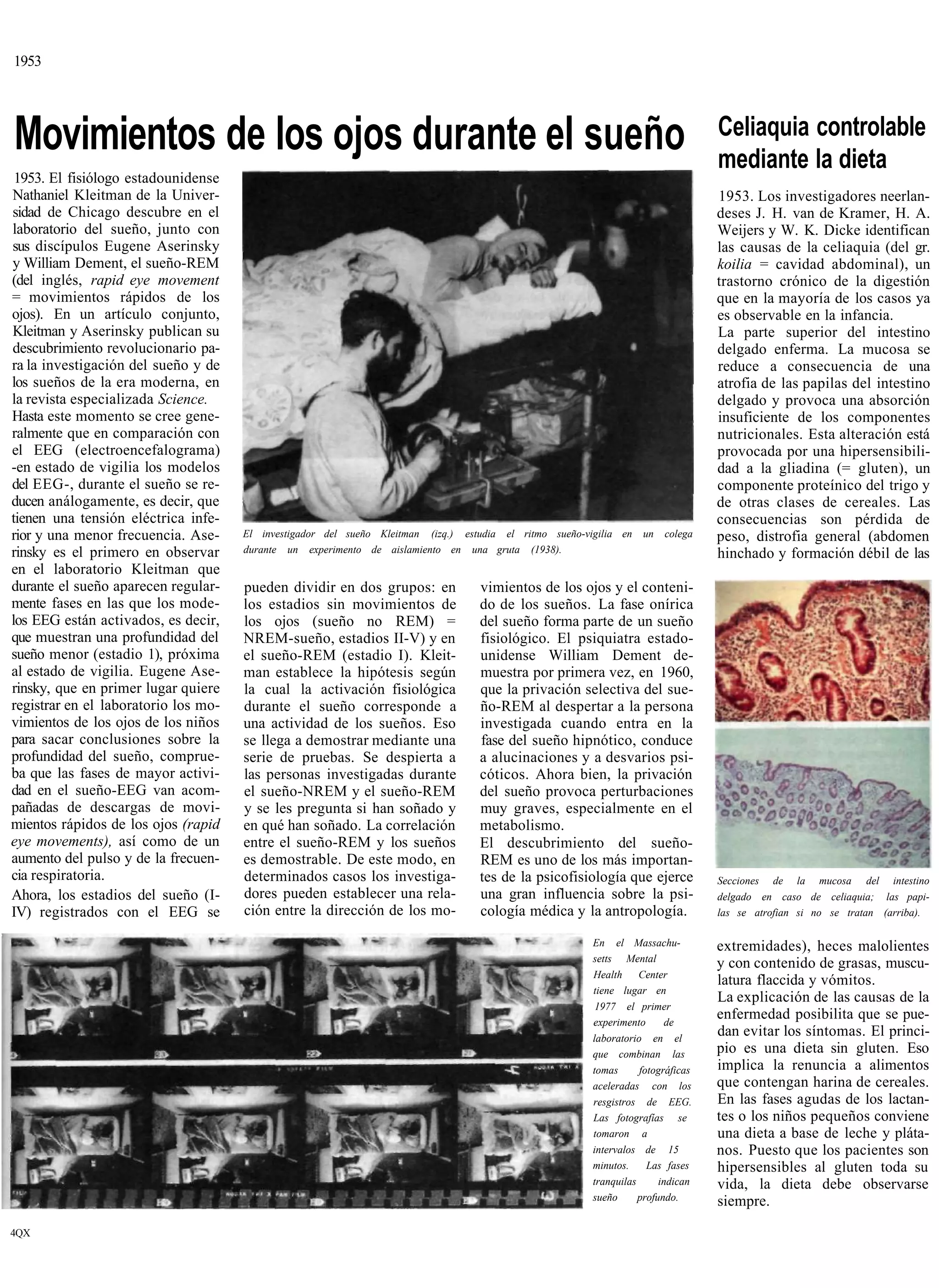 1953




Movimientos de los ojos durante el sueño                                                                                           Celiaquia controlable
                                                                                                                                   mediante la dieta
 1953. El fisiólogo estadounidense
Nathaniel Kleitman de la Univer-                                                                                                   1953. Los investigadores neerlan-
sidad de Chicago descubre en el                                                                                                    deses J. H. van de Kramer, H. A.
laboratorio del sueño, junto con                                                                                                   Weijers y W. K. Dicke identifican
sus discípulos Eugene Aserinsky                                                                                                    las causas de la celiaquia (del gr.
y William Dement, el sueño-REM                                                                                                     koilia = cavidad abdominal), un
(del inglés, rapid eye movement                                                                                                    trastorno crónico de la digestión
= movimientos rápidos de los                                                                                                       que en la mayoría de los casos ya
ojos). En un artículo conjunto,                                                                                                    es observable en la infancia.
Kleitman y Aserinsky publican su                                                                                                   La parte superior del intestino
descubrimiento revolucionario pa-                                                                                                  delgado enferma. La mucosa se
ra la investigación del sueño y de                                                                                                 reduce a consecuencia de una
los sueños de la era moderna, en                                                                                                   atrofia de las papilas del intestino
la revista especializada Science.                                                                                                  delgado y provoca una absorción
Hasta este momento se cree gene-                                                                                                   insuficiente de los componentes
ralmente que en comparación con                                                                                                    nutricionales. Esta alteración está
el EEG (electroencefalograma)                                                                                                      provocada por una hipersensibili-
-en estado de vigilia los modelos                                                                                                  dad a la gliadina (= gluten), un
del EEG-, durante el sueño se re-                                                                                                  componente proteínico del trigo y
ducen análogamente, es decir, que                                                                                                  de otras clases de cereales. Las
tienen una tensión eléctrica infe-                                                                                                 consecuencias son pérdida de
rior y una menor frecuencia. Ase-     El investigador del sueño Kleitman (izq.) estudia el ritmo sueño-vigilia en   un   colega    peso, distrofia general (abdomen
rinsky es el primero en observar      durante un experimento de aislamiento en una gruta (1938).                                   hinchado y formación débil de las
en el laboratorio Kleitman que
durante el sueño aparecen regular-    pueden dividir en dos grupos: en             vimientos de los ojos y el conteni-
mente fases en las que los mode-      los estadios sin movimientos de              do de los sueños. La fase onírica
los EEG están activados, es decir,    los ojos (sueño no REM) =                    del sueño forma parte de un sueño
que muestran una profundidad del      NREM-sueño, estadios II-V) y en              fisiológico. El psiquiatra estado-
sueño menor (estadio 1), próxima      el sueño-REM (estadio I). Kleit-             unidense William Dement de-
al estado de vigilia. Eugene Ase-     man establece la hipótesis según             muestra por primera vez, en 1960,
rinsky, que en primer lugar quiere    la cual la activación fisiológica            que la privación selectiva del sue-
registrar en el laboratorio los mo-   durante el sueño corresponde a               ño-REM al despertar a la persona
vimientos de los ojos de los niños    una actividad de los sueños. Eso             investigada cuando entra en la
para sacar conclusiones sobre la      se llega a demostrar mediante una            fase del sueño hipnótico, conduce
profundidad del sueño, comprue-       serie de pruebas. Se despierta a             a alucinaciones y a desvarios psi-
ba que las fases de mayor activi-     las personas investigadas durante            cóticos. Ahora bien, la privación
dad en el sueño-EEG van acom-         el sueño-NREM y el sueño-REM                 del sueño provoca perturbaciones
pañadas de descargas de movi-         y se les pregunta si han soñado y            muy graves, especialmente en el
mientos rápidos de los ojos (rapid    en qué han soñado. La correlación            metabolismo.
eye movements), así como de un        entre el sueño-REM y los sueños              El descubrimiento del sueño-
aumento del pulso y de la frecuen-    es demostrable. De este modo, en             REM es uno de los más importan-
cia respiratoria.                     determinados casos los investiga-            tes de la psicofisiología que ejerce            Secciones de la mucosa del intestino
Ahora, los estadios del sueño (I-     dores pueden establecer una rela-            una gran influencia sobre la psi-               delgado en caso de celiaquia; las papi-
IV) registrados con el EEG se         ción entre la dirección de los mo-           cología médica y la antropología.               las se atrofian si no se tratan (arriba).

                                                                                                         En el Massachu-           extremidades), heces malolientes
                                                                                                         setts Mental
                                                                                                                                   y con contenido de grasas, muscu-
                                                                                                         Health     Center
                                                                                                                                   latura flaccida y vómitos.
                                                                                                         tiene lugar en
                                                                                                                                   La explicación de las causas de la
                                                                                                          1977 el primer
                                                                                                         experimento       de
                                                                                                                                   enfermedad posibilita que se pue-
                                                                                                         laboratorio en el
                                                                                                                                   dan evitar los síntomas. El princi-
                                                                                                         que combinan las          pio es una dieta sin gluten. Eso
                                                                                                         tomas      fotográficas   implica la renuncia a alimentos
                                                                                                         aceleradas con los        que contengan harina de cereales.
                                                                                                         resgistros de EEG.        En las fases agudas de los lactan-
                                                                                                         Las fotografías se        tes o los niños pequeños conviene
                                                                                                         tomaron a                 una dieta a base de leche y pláta-
                                                                                                         intervalos de 15          nos. Puesto que los pacientes son
                                                                                                         minutos.     Las fases    hipersensibles al gluten toda su
                                                                                                         tranquilas      indican   vida, la dieta debe observarse
                                                                                                         sueño      profundo.      siempre.

4QX
 