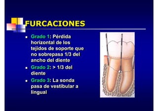 FURCACIONES
FURCACIONES
„ Grado 1: Pérdida
horizontal de los
tejidos de soporte que
no sobrepasa 1/3 del
ancho del diente
„ Grado 2: > 1/3 del
diente
„ Grado 3: La sonda
pasa de vestibular a
lingual
„
„ Grado 1
Grado 1: P
: Pé
érdida
rdida
horizontal de los
horizontal de los
tejidos de soporte que
tejidos de soporte que
no sobrepasa 1/3 del
no sobrepasa 1/3 del
ancho del diente
ancho del diente
„
„ Grado 2
Grado 2: > 1/3 del
: > 1/3 del
diente
diente
„
„ Grado 3
Grado 3: La sonda
: La sonda
pasa de vestibular a
pasa de vestibular a
lingual
lingual
 