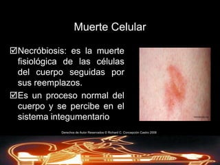 Es un termino legal, pero no tiene cabida como parte del léxico en las Ciencias Mortuorias