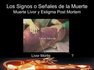 La muerte total del organismo se refiere a la perdida de la habilidad del cuerpo funcionar como una criatura organizadaDerechos de AutorReservados © Richard C. Concepción Castro 2008