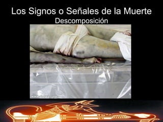 Muerte CelularSe define sencillamente como la muerte de la célula