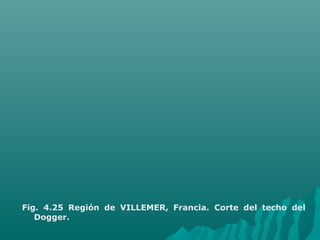 Fig. 4.25 Región de VILLEMER, Francia. Corte del techo del 
Dogger. 
 