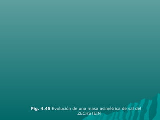 Fig. 4.45 Evolución de una masa asimétrica de sal del 
ZECHSTEIN 
 