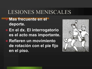 en decúbito lateral se toma el talón con una mano y con la otra apoyada sobre el extremo proximal y lateral de la pierna se realiza simultáneamente un movimiento de flexión y valgo con rotación interna  Positivo : se produce un franco resalto.