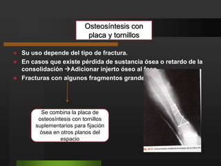 Exploración físicaInspecciónHueso subcutáneo.Examinarse el estado de la piel retirando vendajes.Tomar pulsosTibial posterior y pedio.Evaluar movilidad del pie.FRACTURAS DE LA PIERNAComplicación vascular  fracturas de tercio proximal con desplazamiento.