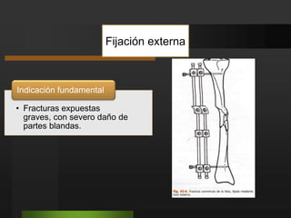 TratamientoFRACTURAS DE LA PIERNA