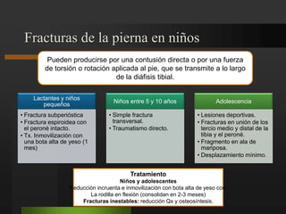 FRACTURAS DE LA PIERNA