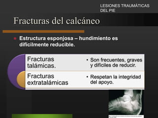 FRACTURAS DE LA PIERNAImplantes elásticos.