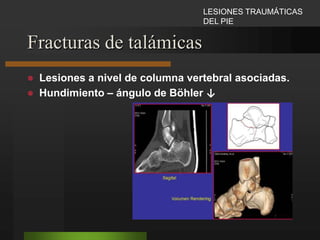 Ejercen su acción tomando tres puntos de apoyo dentro del conducto medular y estabilizando así la fractura.