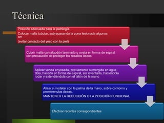 Retardo de consolidación.