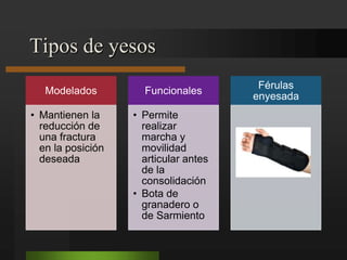Rx: esclerosis de los extremos fracturariosa nivel del conducto medular.