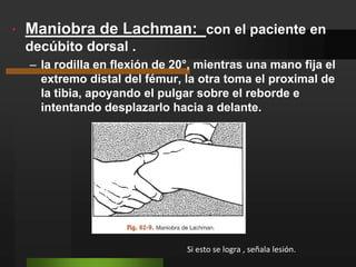 Maniobra de Lachman:  con el paciente en decúbito dorsal .