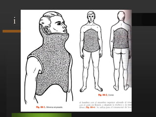 Fracturas del astrágalo.60% de su superficie carece de afluencia vascular.Cubierta de cartílago articular.No tiene inserciones musculares.LESIONES TRAUMÁTICAS DEL PIE