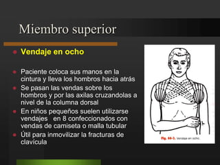 Fracturas del cuello del astrágalo.50% de las fracturas del astrágalo.Caída de cierta altura con el píe en flexión dorsal.Puede estar asociada fx del maléolo tibial.LESIONES TRAUMÁTICAS DEL PIE