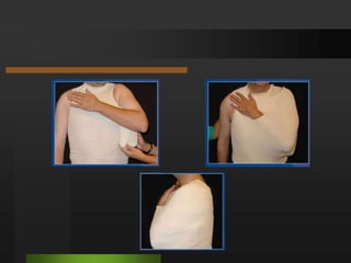 Tratamiento LESIONES TRAUMÁTICAS DEL PIEFracturas del cuello del astrágalo.