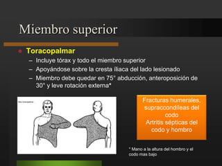 Fracturas del cuerpo del astrágalo15-20% de las fracturas del astrágalo.LESIONES TRAUMÁTICAS DEL PIELESIONES TRAUMÁTICAS DEL PIECuando no hay desplazamiento se tratan de modo incruento.