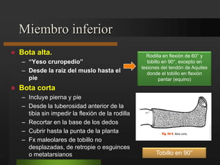 Fracturas ExtratalámicasFracturas de la tuberosidad mayor:LESIONES TRAUMÁTICAS DEL PIE