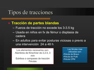 Inmovilización con yesoMétodo más utilizado para el tratamiento de:Lesiones osteoarticulaesLesiones muscularesContención posoperatoriaPara la confección de vendas enyesadas se utiliza:Gasa gruesa o tartalinaSulfato de calcio calcinadoMalla tubular Algodón laminado u ovata4 o 5 m de largo10,15,20 cm de ancho