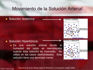 Solución Isotónica:Solución Hipertónica:Es una solución arterial donde la humedad del tejido es reemplazada cuando ésta solución es inyectada.  Se utiliza en los casos deshidratados.  Esta solución tiene una densidad menor.Movimiento de la Solución ArterialDerechos de Autor Reservados © Richard C. Concepción Castro 2008