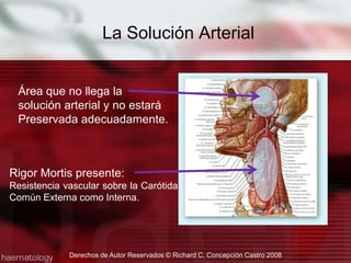 Resistencia Extravascular: Es la resistencia externa que comprime o colapsa los vasos sanguíneos y entorpece el pasaje de los líquidos.Peso de las vísceras torácicas y abdominales: el peso de los órganos contra la vena cava inferior y la aorta puede causar una compresión vascular considerable en el cuerpo fallecido según yace en posición dorsal.La Solución ArterialDerechos de Autor Reservados © Richard C. Concepción Castro 2008