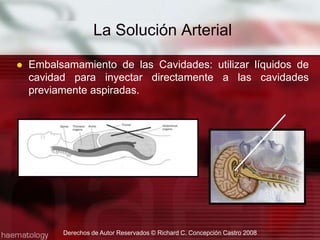 Embalsamamiento de las Cavidades: utilizar líquidos de cavidad para inyectar directamente a las cavidades previamente aspiradas.La Solución Arterial Derechos de Autor Reservados © Richard C. Concepción Castro 2008