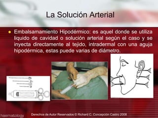 Embalsamamiento Hipodérmico: es aquel donde se utiliza liquido de cavidad o solución arterial según el caso y se inyecta directamente al tejido, intradermal con una aguja hipodérmica, estas puede varias de diámetro.La Solución Arterial Derechos de Autor Reservados © Richard C. Concepción Castro 2008