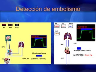 Detección de embolismo 