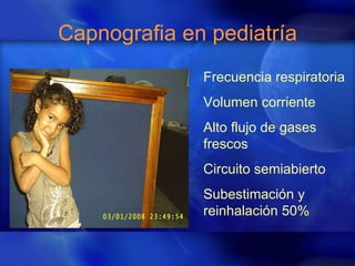 Capnografia en pediatría Frecuencia respiratoria Volumen corriente Alto flujo de gases frescos Circuito semiabierto Subestimación y reinhalación 50%                                                                                                                                                                                                                                                                                                                                                                                         