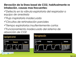 Elevación de la línea basal de CO2, habitualmente re
inhalación, causas mas frecuentes:
Defecto en la válvula espiratoria del respirador o
equipo de anestesia
Flujo inspiratorio inadecuado
Circuitos de rehinalación parciales
Tiempo espiratorios insufientemente cortos
Funcionamiento inadecuado del sistema de
absorción de CO2
 