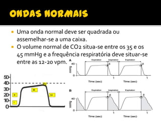 Uma onda normal deve ser quadrada ou
assemelhar-se a uma caixa.
 O volume normal de CO2 situa-se entre os 35 e os
45 mmHg e a frequência respiratória deve situar-se
entre as 12-20 vpm.


 