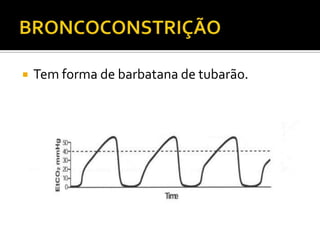 

Tem forma de barbatana de tubarão.

 
